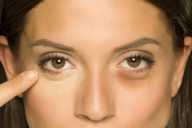 5 mënyra për të reduktuar pamjen e qeskave nën sy me grim