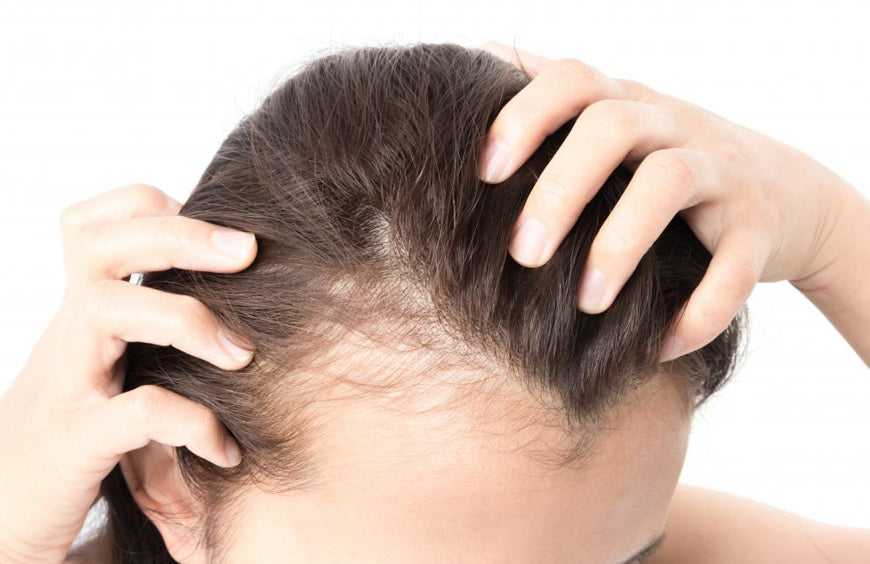 Çfarë mund të shkaktojë humbje të tepërt të flokëve?